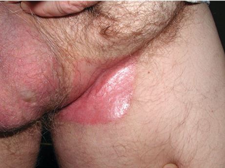 skin findings image